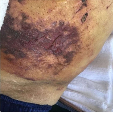 赤峰專業(yè)祛疤店地址電話號(hào)碼-第1張圖片