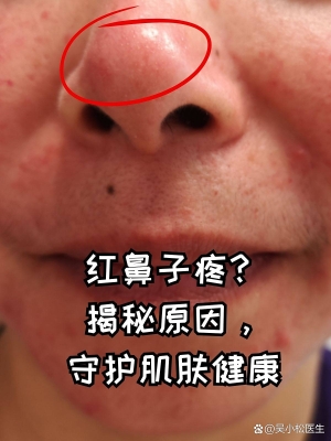 赤峰肌膚醫(yī)生加盟店電話號(hào)碼-第1張圖片