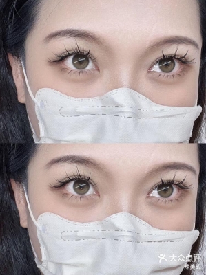 赤峰接睫毛單根醫(yī)院電話號碼-第1張圖片