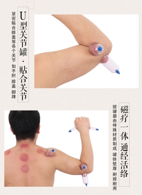 赤峰拔罐店鋪電話號(hào)碼查詢-第1張圖片