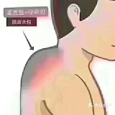 赤峰新城肩頸疏通店電話號(hào)碼-第1張圖片