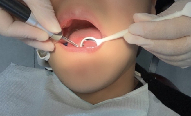 赤峰哪里弄牙比較好-第1張圖片