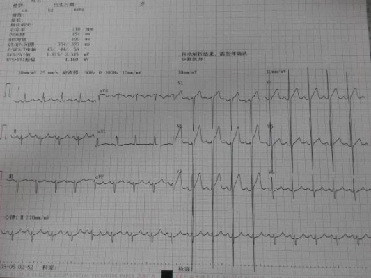 赤峰市醫(yī)院腦電圖室電話號(hào)碼-第1張圖片