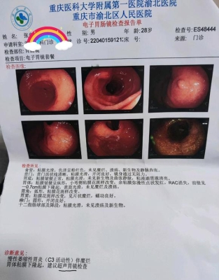 赤峰市于生志胃病電話-第1張圖片