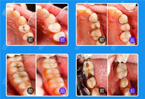 赤峰耳釘修復(fù)店地址電話號碼-第1張圖片